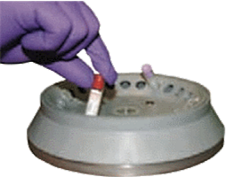 Относим пробы крови животного в лабораторию и проводим центрифугирование для выделения сыворотки