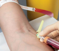 Закрытые системы взятия венозной крови с использованием S-MONOVETTE